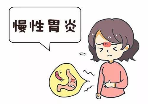 慢性胃炎