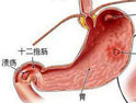 十二指肠炎