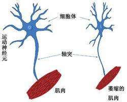 运动神经元病