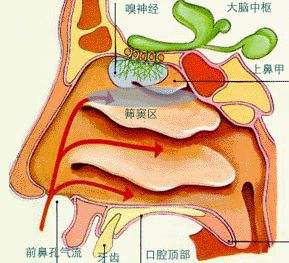 慢性上颌窦炎