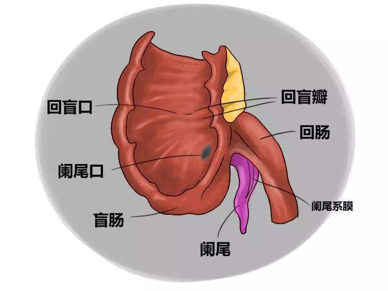 急性阑尾炎