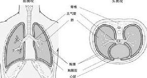 胸膜炎