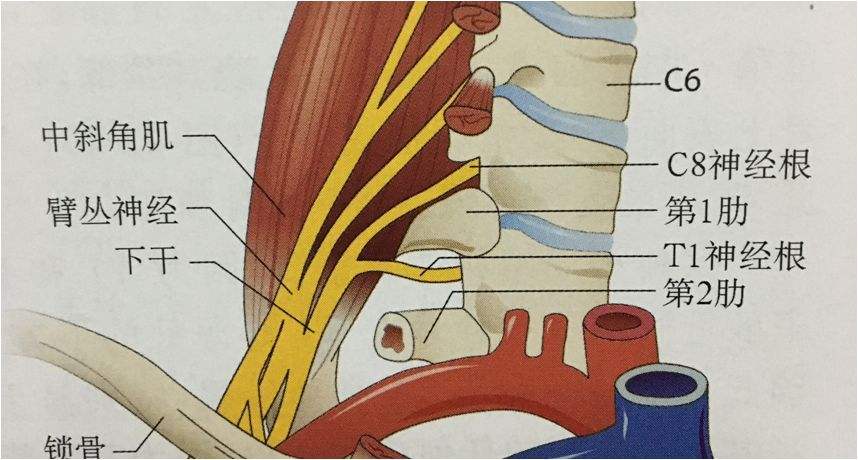 胸廓出口综合症