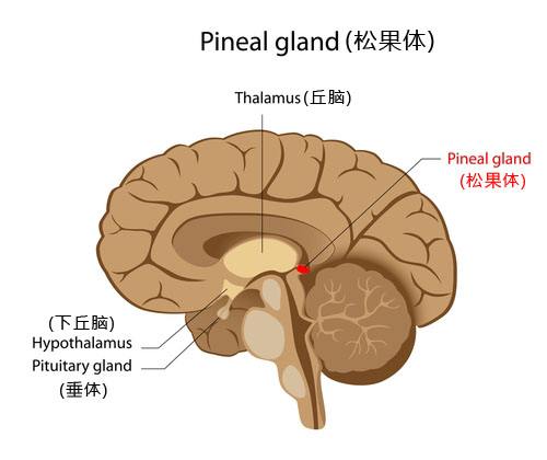 松果体区瘤