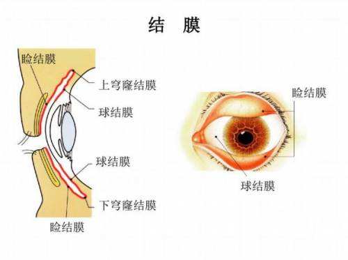 结膜炎