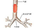 气管肿瘤