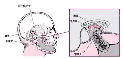 颞下颌关节病